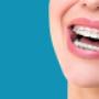 orthodontics