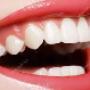 Clear Smiles Ortho