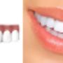iSmile Dental Centre