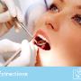 Tooth Extractions