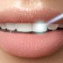 Dentist 1