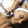Microdermabrasion
