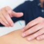 Acupuncture