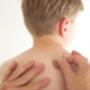 Pediatric Acupuncture