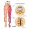 Sciatica-Treatment