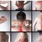 shoulder-elbow-wrist-pain