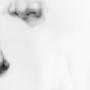 Rhinoplasty Surgery Melbourne