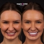 Laura before and after