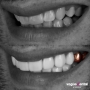 Before and After GOLD crown and veneers