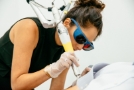 Laser Tattoo Removal Jamie