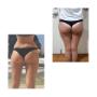 Fat freezing,
Aka... The fabulous Australian Bum Lift.
Results from 12 weeks.
Walk in / Walk out treatment.
Freeze your fat in your lunch hour.
Beyond Skin Face & Body.