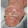 Skin Needling,
Not fancy but results driven take a few years off your face  great results.
Beyond Skin Face And Body.