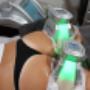 Fat freezing..
The best way to get the great Australian Bum..
Results 12 weeks.
Beyond Skin Face And Body.