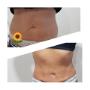 Fat Freezing....
Who said magic don't happen..
WOW..
No needles.
No surgery.
No recovery time.
Call for your free consultation.
0403463203