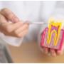 Root Canal Noble Park