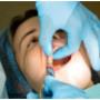 Wisdom Teeth Removal Springvale