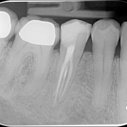 The Endodontic Centre