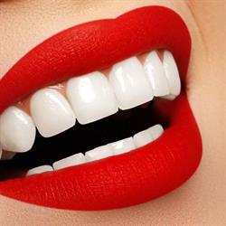 Pearl White Smile Cosmetic Teeth Whitening