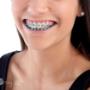 Braces
