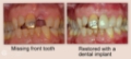 About - Putney Dental Care