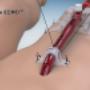 Bi-Flow cannula