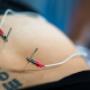 electro dry needling brisbane