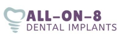 All-On-8 Dental Implants