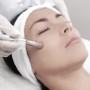 Microdermabrasion Toowoomba