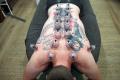 Cupping-Therapy
