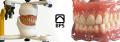 BPS-Dentures-Edit-Delete