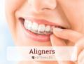 Aligners