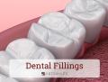 Dental Fillings