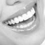 Digital Smile Design