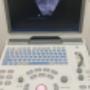 Ultrasound - for pelvic floor, abdominal muscles- physiotherapy, Annandale