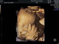 Coast Women's Imaging