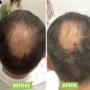 # 824