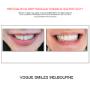 Grab a huge Saving with our PREPLESS OR NO-PREP Porcelain Veneer Specials and Packages