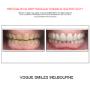 Grab a huge Saving with our PREPLESS OR NO-PREP Porcelain Veneer Specials and Packages
