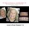 PREPLESS-porcelain-veneer