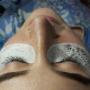 Eye Services