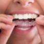 straighten-teeth