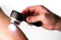 DermLite DL4 Hand-Held Dermatoscope with Pigment Boost