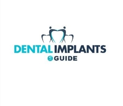 Dental Implants Guide