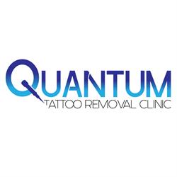 Quantum Tattoo Removal Clinic
