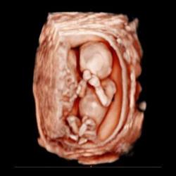 Baby Ultrasound Studio