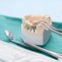 dentist-annerley-3