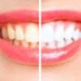 dentist-annerley-5