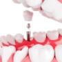 dentist-annerley-6