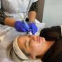 HYDRODERMABRASION