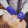 Lip Filler